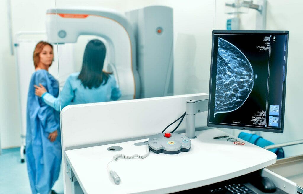 專家建議女性乳腺篩查年齡下調至40歲